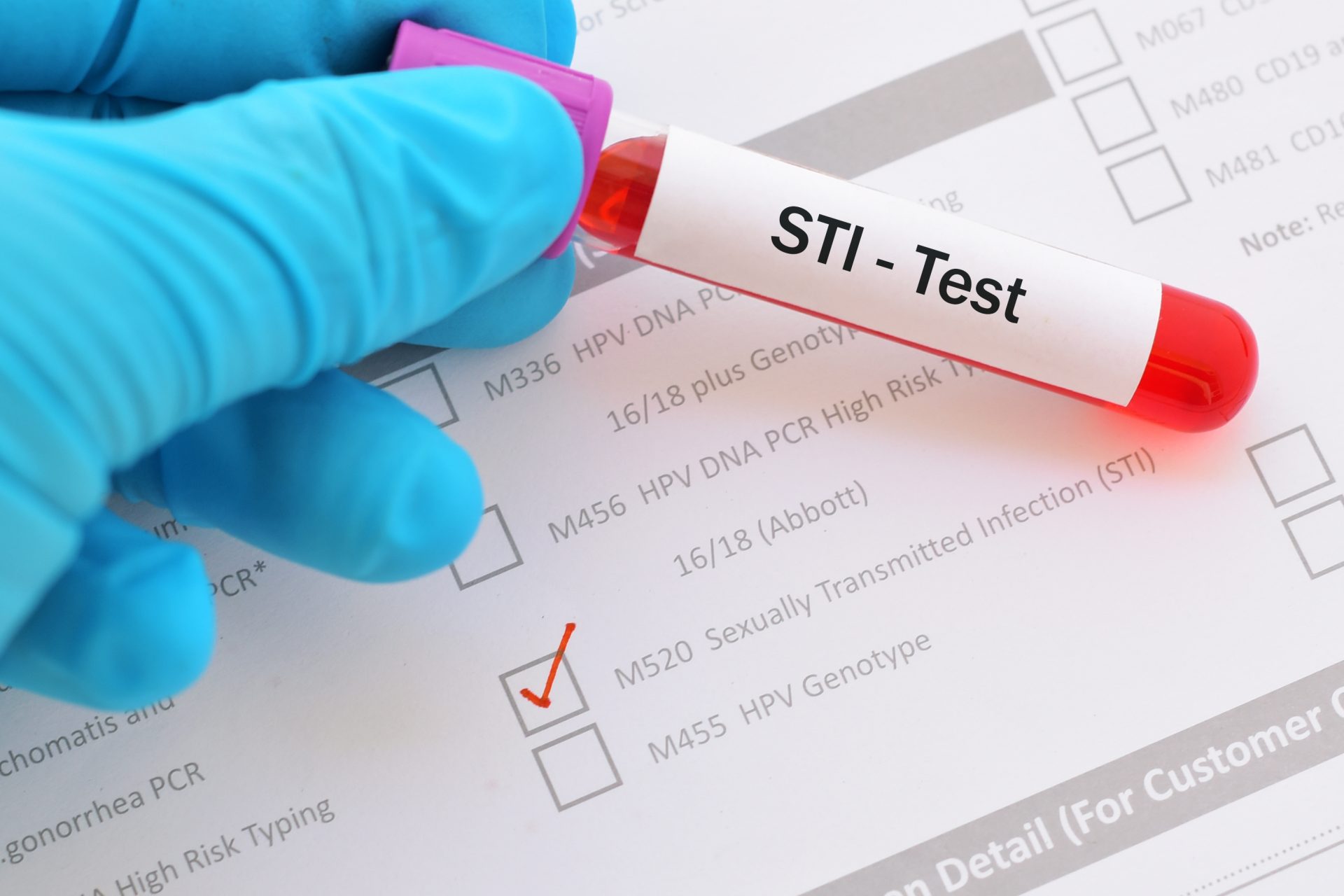 STI watch