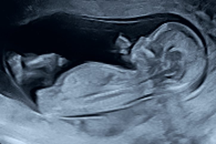 Prenatal care