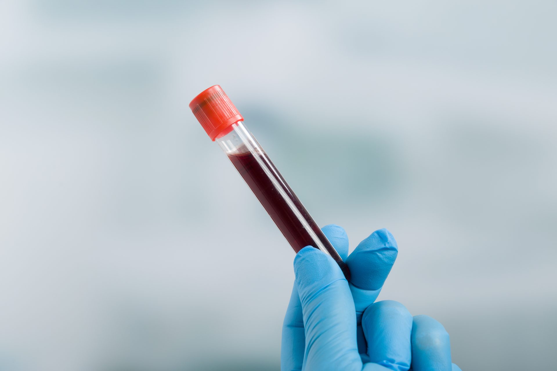 Non-invasive prenatal testing (NIPT)