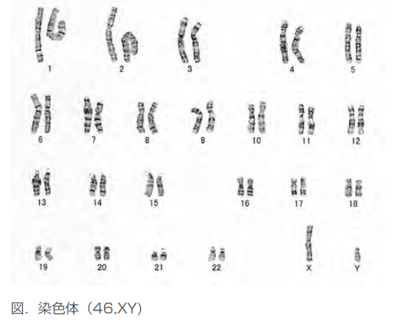 羊水検査(妊娠16週～)/絨毛検査(妊娠11～14週）