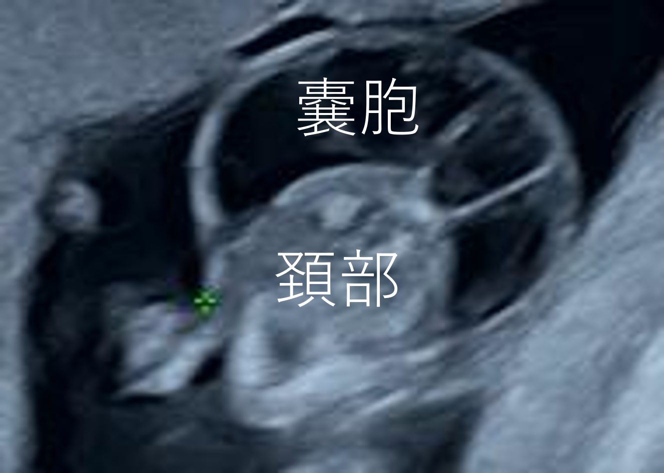 胎児の病気相談外来
