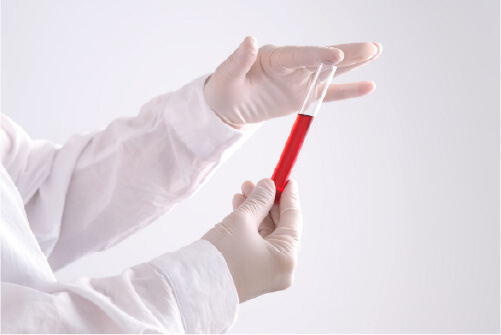Basic Health Screening – ¥27,500 (tax included)